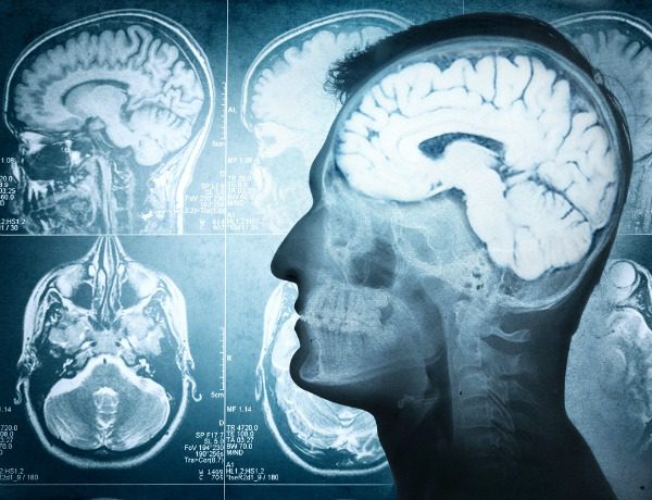 Brain x-rays