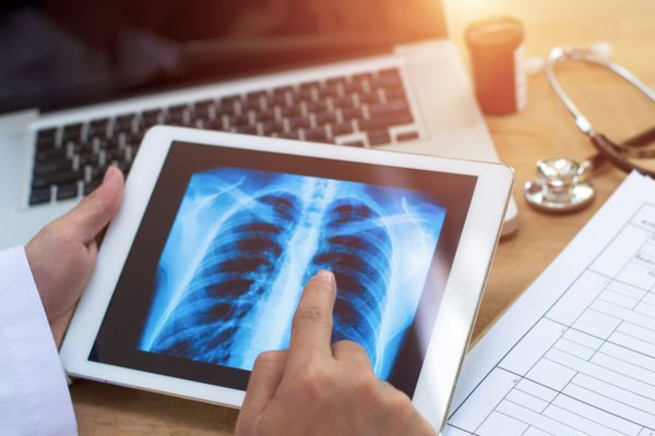 Doctor reviewing xray
